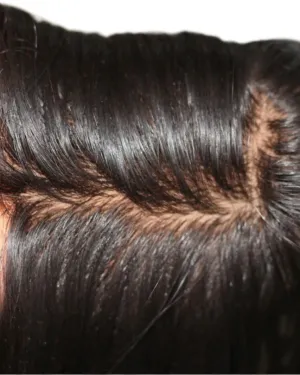 SHC Silk Base Closure